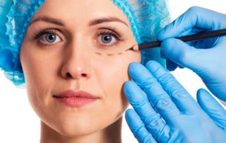 ¿Qué es la cirugía oculoplástica?