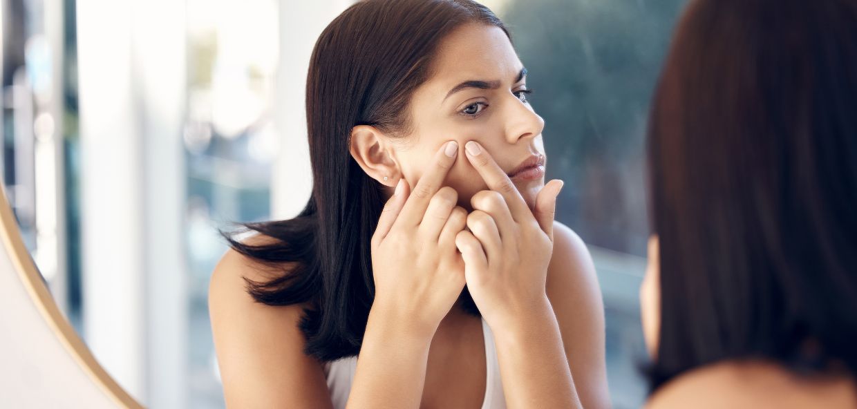 Tratamientos de medicina estética para eliminar las marcas del acné